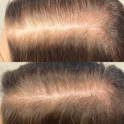 Evolve Scalp Health & Wellness – photo 2