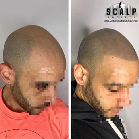 Scalp Society – photo 5