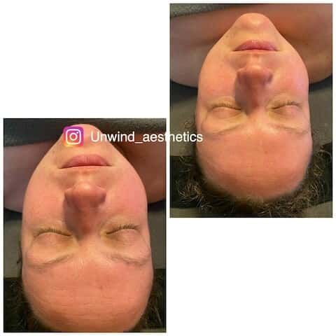 Unwind Head Spa & Salon, LLC – photo 4