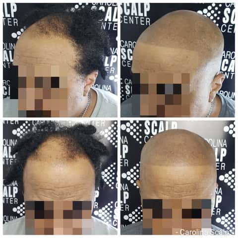 Carolina Scalp Center, head spa in Raleigh, NC