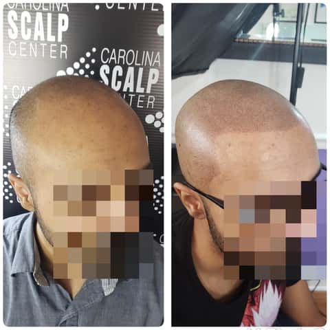 Carolina Scalp Center – photo 4