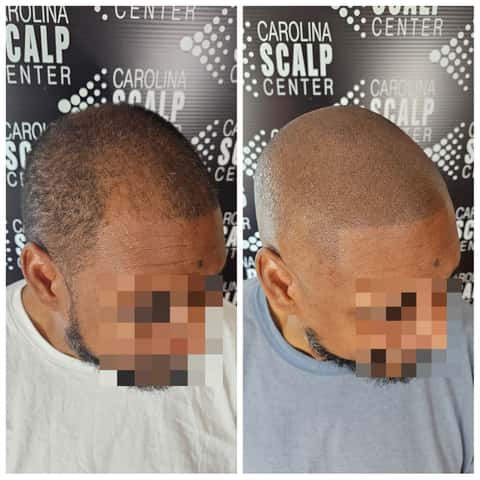 Carolina Scalp Center – photo 5