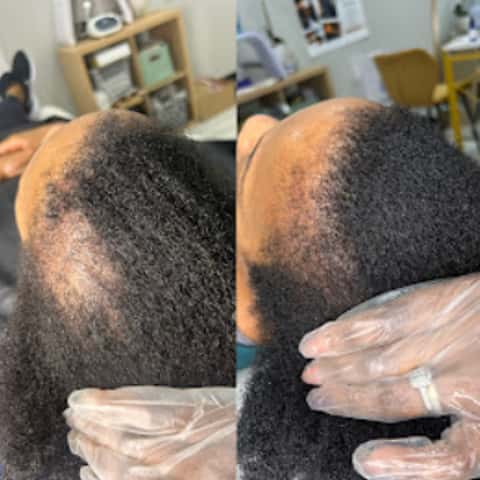 NHCG Trichology - Hair Restoration & Head Spa, head spa in Katy, TX