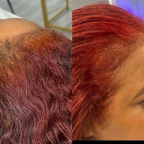 NHCG Trichology - Hair Restoration & Head Spa – photo 4