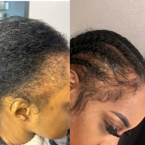 NHCG Trichology - Hair Restoration & Head Spa – photo 5