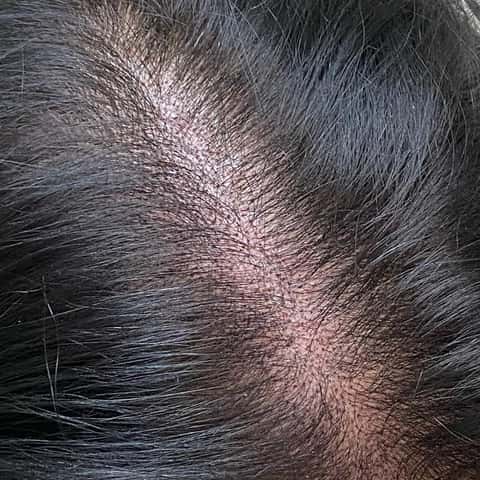 Scalp Prodigy – photo 3