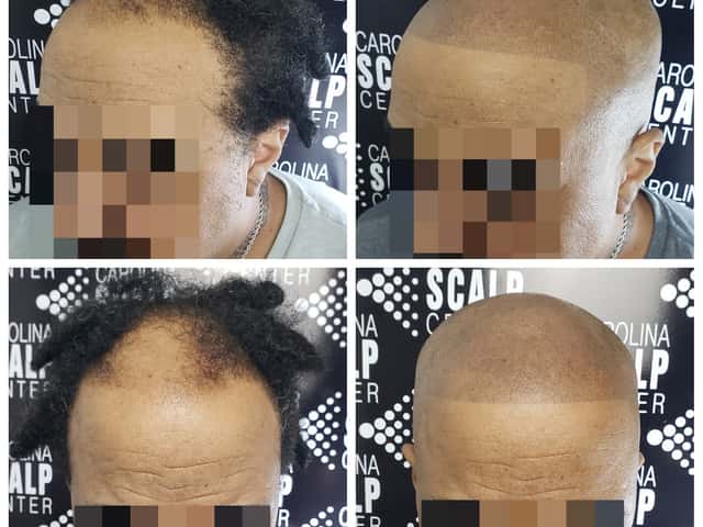Carolina Scalp Center, head spa in Raleigh, NC