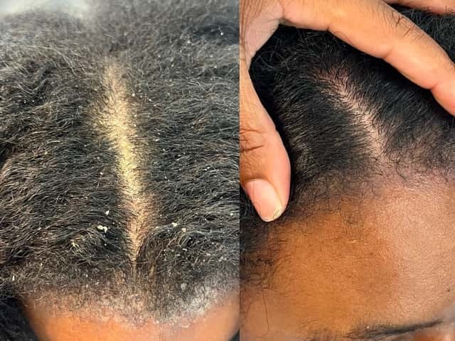 Scalphq Head & Scalp Spa, head spa in Houston, TX